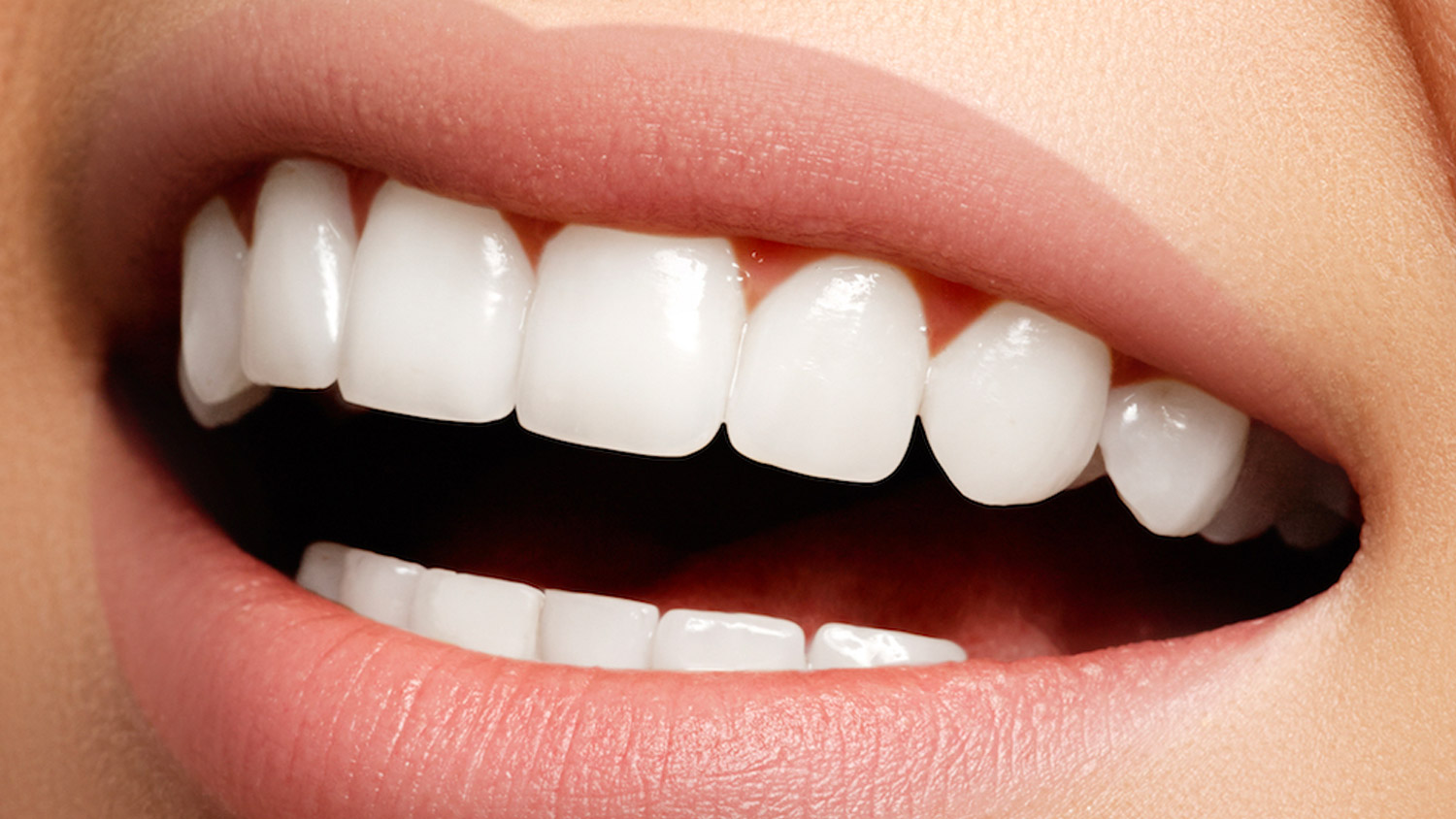 orthodontie-contention-poissy